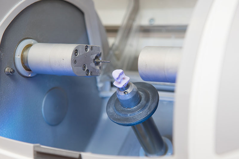 Cerec in Tucson