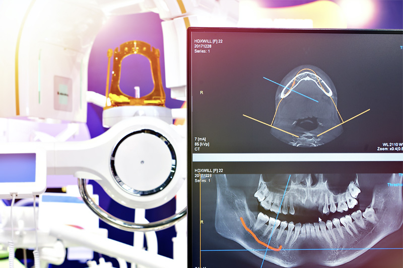 Cone Beam CT Imaging in Tucson